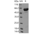 Recombinant Human GALNT2/GalNAc-T2 Protein (His Tag) - ABMIUM