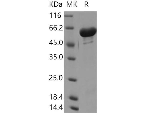 Recombinant Human GALNT2/GalNAc-T2 Protein (His Tag) - ABMIUM