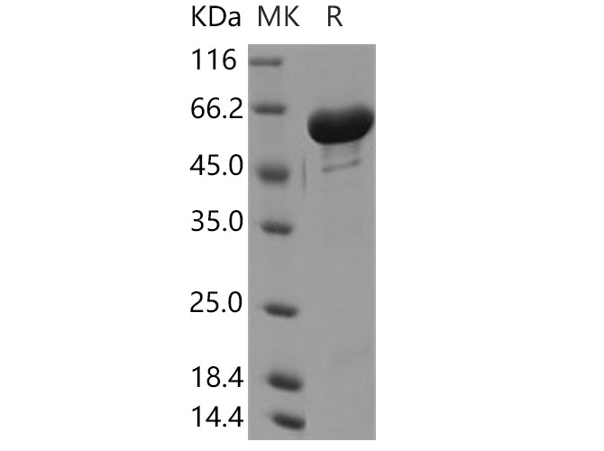Recombinant Human GALNT2/GalNAc-T2 Protein (His Tag) - ABMIUM