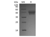 Recombinant Human BTN2A1 Protein (His Tag) - ABMIUM