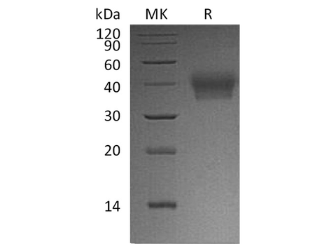 Recombinant Human BTN2A1 Protein (His Tag) - ABMIUM