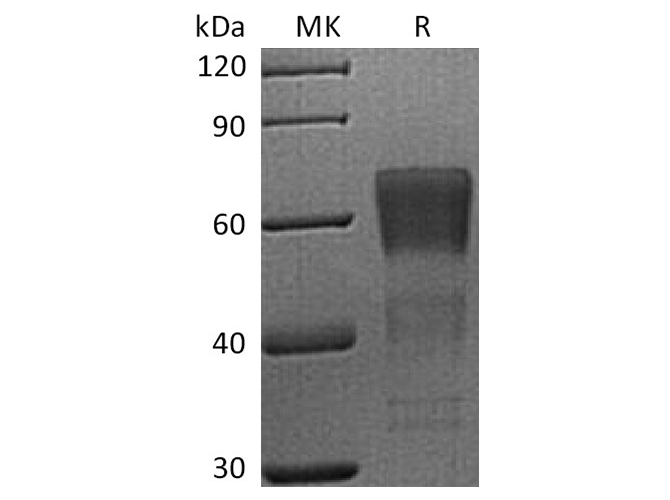 Recombinant Human CD28/TP44 Protein (mFc Tag) - ABMIUM