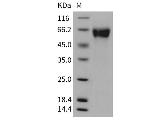 Recombinant Rat GFRA1/GDNFRA Protein (His Tag) - ABMIUM