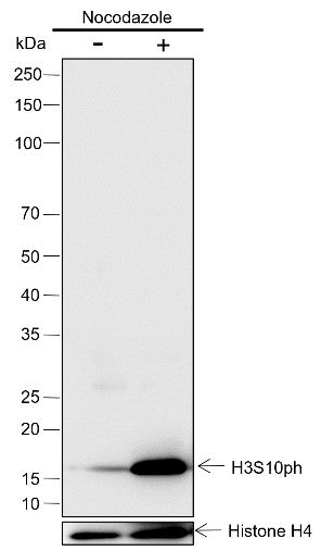 Anti-Human/Mouse Phospho-Histone H3 (Ser10) Antibody [A829] - ABMIUM