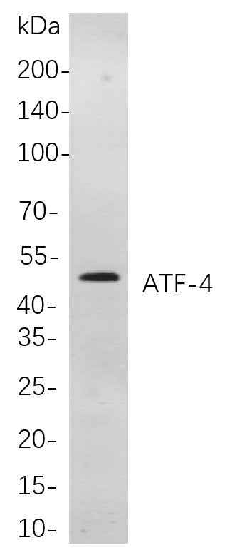 Anti-Human/Mouse/Rat ATF-4 Antibody [B792] - ABMIUM