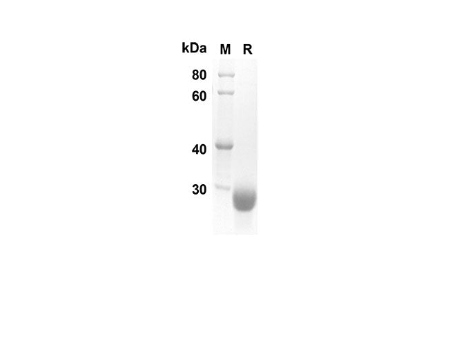 SDS-PAGE analysis of Human NBL1 proteins, 2 μg/lane of Recombinant Human NBL1 proteins was resolved with SDS-PAGE under reducing conditions, showing bands at 18 kDa.