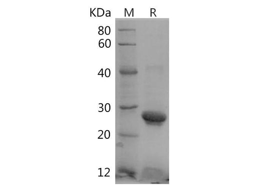 SDS-PAGE analysis of Human Rac1 proteins, 2 μg/lane of Recombinant Human Rac1 proteins was resolved with SDS-PAGE under reducing conditions, showing bands at 27 kDa.