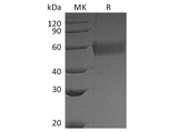 Recombinant Vaccinia virus Soluble Interferon α/β Receptor B18 Protein (His Tag) - ABMIUM