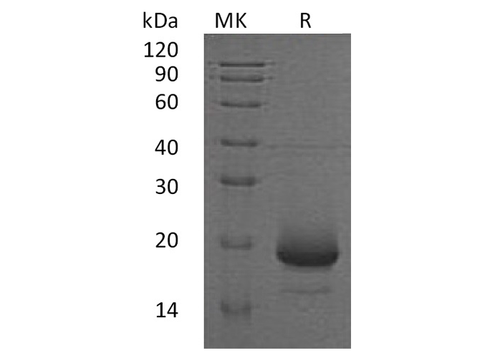Recombinant Human Interleukin-4/IL-4 Protein (His Tag) - ABMIUM