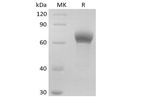 Recombinant Human Dickkopf-Related Protein 1/DKK-1 (C-Fc) - ABMIUM