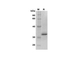 SDS-PAGE analysis of Human INHBA proteins, 2 μg/lane of Recombinant Human INHBA proteins was resolved with SDS-PAGE under reducing conditions, showing bands at 33 kDa.
