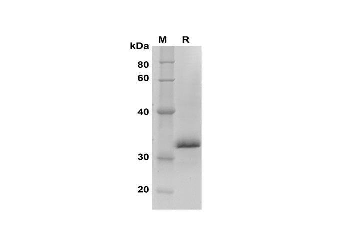 SDS-PAGE analysis of Human INHBA proteins, 2 μg/lane of Recombinant Human INHBA proteins was resolved with SDS-PAGE under reducing conditions, showing bands at 33 kDa.