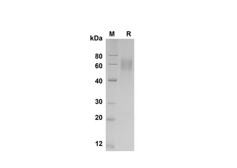 SDS-PAGE analysis of Human IL-18 BPa proteins , 2 μg/lane of Recombinant Human IL-18 BPa proteins was resolved with SDS-PAGE under reducing conditions , showing bands at 60 kDa.