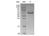 Recombinant Human TIGIT Protein (Fc Tag) - ABMIUM