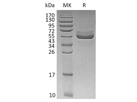 Recombinant Human TIGIT Protein (Fc Tag) - ABMIUM