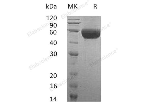 Recombinant Human Neurotrimin/NTM Protein (His Tag) - ABMIUM