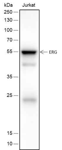 Anti-Human/Rat/Mouse ERG Antibody [A423]