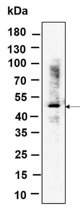 Anti-Human/Mouse/Rat RGS6 Antibody [B993]