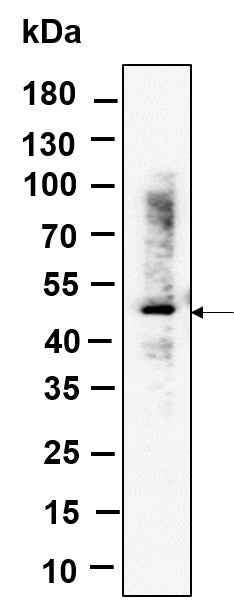 Anti-Human/Mouse/Rat RGS6 Antibody [B993]