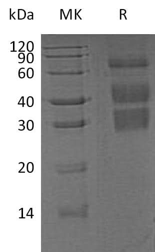 Recombinant Mouse Clusterin/ApoJ Protein (His Tag) - ABMIUM