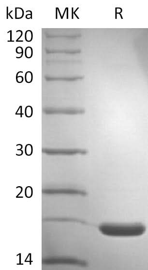 Recombinant SARS-CoV-2 NP NTD domain V2(His Tag) - ABMIUM