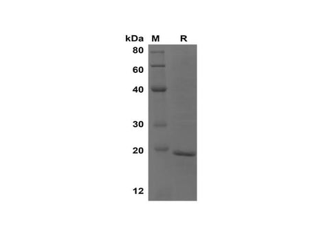 SDS-PAGE analysis of Mouse IL-1b proteins, 2 μg/lane of Recombinant Mouse IL-1b proteins was resolved with SDS-PAGE under reducing conditions, showing bands at 19 kDa.