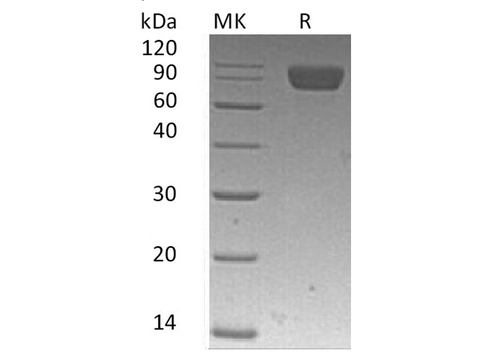 Recombinant Human PDGFRa/CD140a Protein (His Tag) - ABMIUM