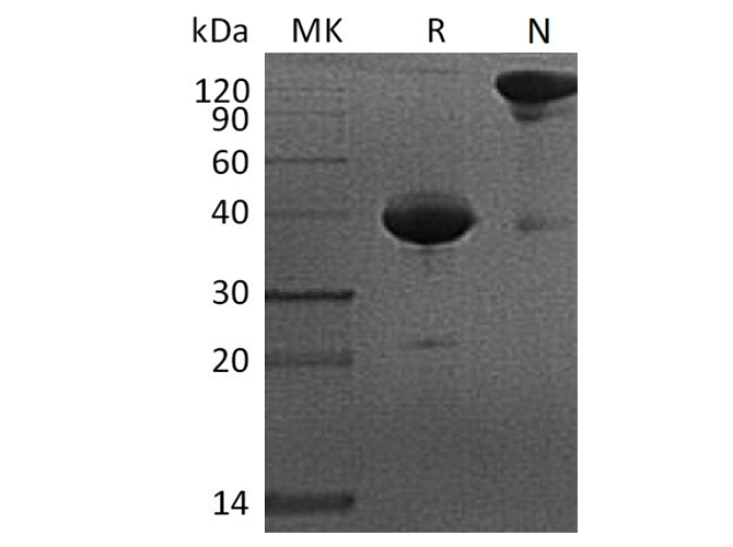Recombinant Cynomolgus BCMA/TNFRSF17/CD269 Protein (Fc Tag) - ABMIUM
