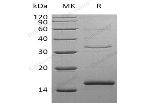 Recombinant Human Cystatin S/CST4 Protein (His Tag) - ABMIUM