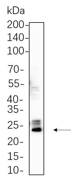 Anti-Human/Mouse/Rat Bak Antibody [B771] - ABMIUM