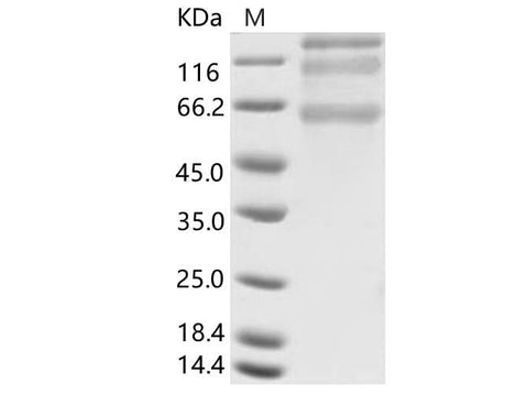 > 75 % as determined by reducing SDS-PAGE.