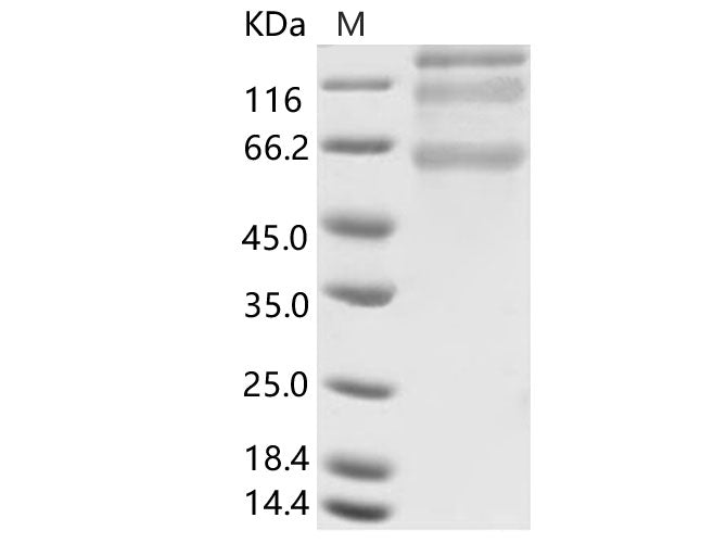 > 75 % as determined by reducing SDS-PAGE.