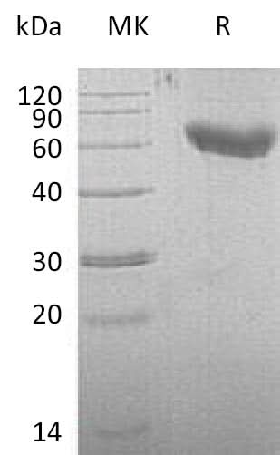 Recombinant Mouse CD28/TP44 Protein (Fc & His Tag) - ABMIUM