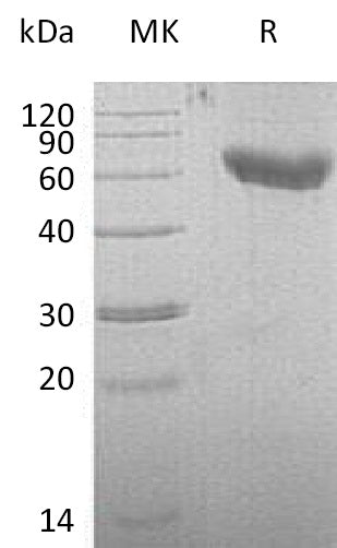 Recombinant Mouse CD28/TP44 Protein (Fc & His Tag) - ABMIUM