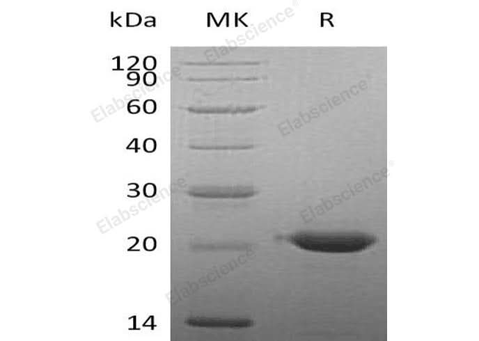 Recombinant Human CLEC3B/Tetranectin Protein (His Tag) - ABMIUM