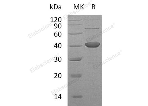 Recombinant Human SORD Protein (His Tag) - ABMIUM