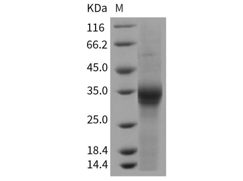 > 91 % as determined by reducing SDS-PAGE.