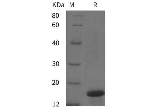 SDS-PAGE analysis of Human IL2/IL-2/Interleukin-2 proteins, 2 μg/lane of Recombinant Human IL2/IL-2/Interleukin-2 proteins was resolved with SDS-PAGE under reducing conditions, showing bands at 17 kDa.