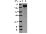 Recombinant Human CDCP1/CD318 Protein (Fc Tag) - ABMIUM