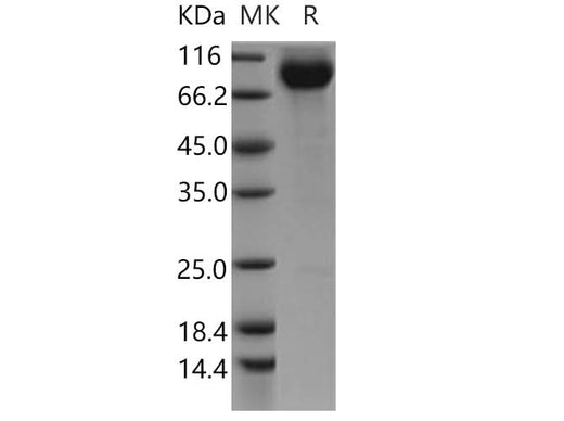 Recombinant Human CDCP1/CD318 Protein (Fc Tag) - ABMIUM