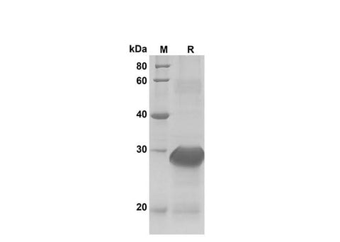 SDS-PAGE analysis of Rat CCL2/JE/MCP-1 proteins, 2 μg/lane of ReCombinant Rat CCL2/JE/MCP-1 proteins was resolved with SDS-PAGE under reducing conditions, showing bands at 30 kDa.