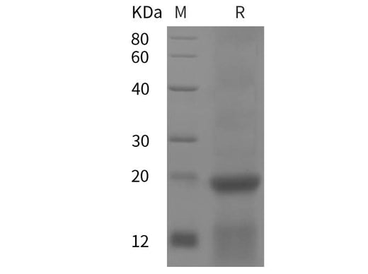 SDS-PAGE analysis of Human Ribosomal proteins, 2 μg/lane of Recombinant Human Ribosomal proteins was resolved with SDS-PAGE under reducing conditions, showing bands at 20 kDa.