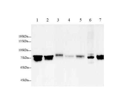 Anti-Human/Mouse/Rat GRP78 Antibody - ABMIUM