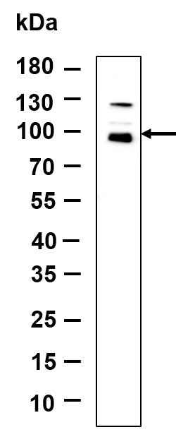 Anti-Human/Mouse/Rat Nibrin Antibody [B893] - ABMIUM