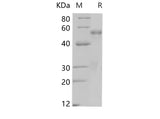 SDS-PAGE analysis of Human PTEN proteins, 2 μg/lane of Recombinant Human PTEN proteins was resolved with SDS-PAGE under reducing conditions, showing bands at 49.1 kDa.