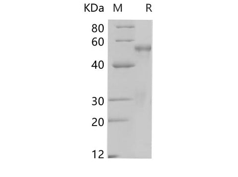 SDS-PAGE analysis of Human PTEN proteins, 2 μg/lane of Recombinant Human PTEN proteins was resolved with SDS-PAGE under reducing conditions, showing bands at 49.1 kDa.