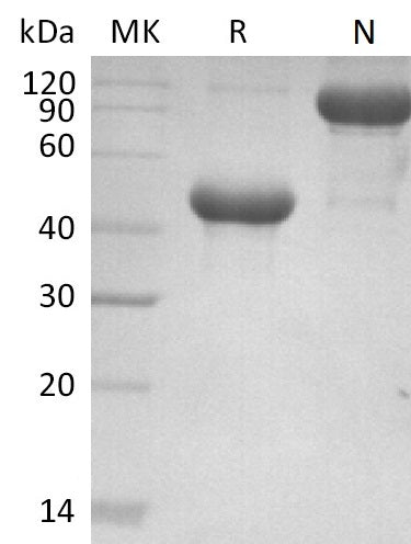 Recombinant Mouse APRIL/TNFSF13 Protein (Fc Tag) - ABMIUM