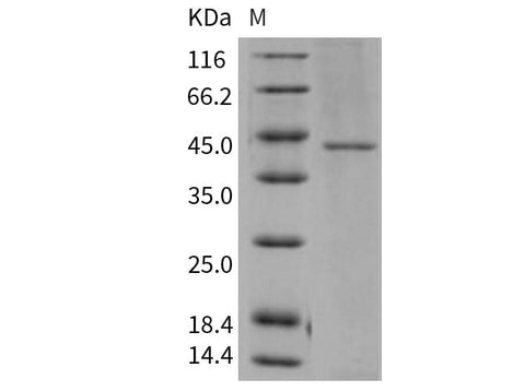 Recombinant Human TCN2 Protein (His Tag) - ABMIUM