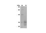 SDS-PAGE analysis of Human IL-7 proteins, 2 μg/lane of Recombinant Human IL-7 proteins was resolved with SDS-PAGE under reducing conditions, showing bands at 25-32 kDa.
