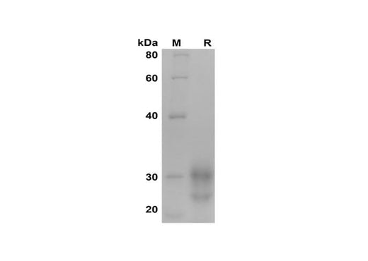 SDS-PAGE analysis of Human IL-7 proteins, 2 μg/lane of Recombinant Human IL-7 proteins was resolved with SDS-PAGE under reducing conditions, showing bands at 25-32 kDa.